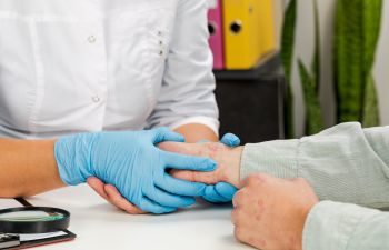 A doctor examining pateint's hand with red spots.